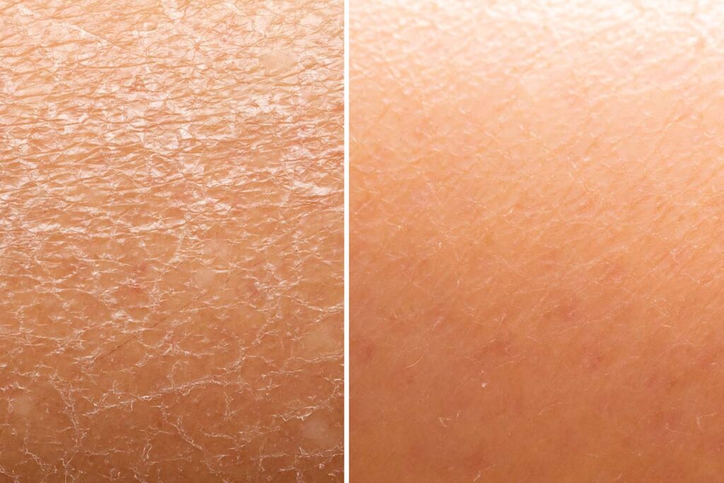 Moisturizer: Trockene Haut vs gepflegte Haut